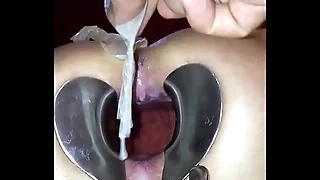 4 anon loads for a cum dump